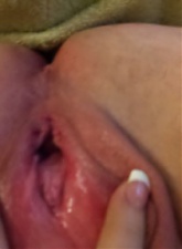 Amateur Fisting - 6 anal pictures